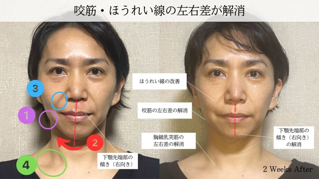 HEAD DRIVER – 頭・首・肩 専用 Face-Pointer – CoreFit